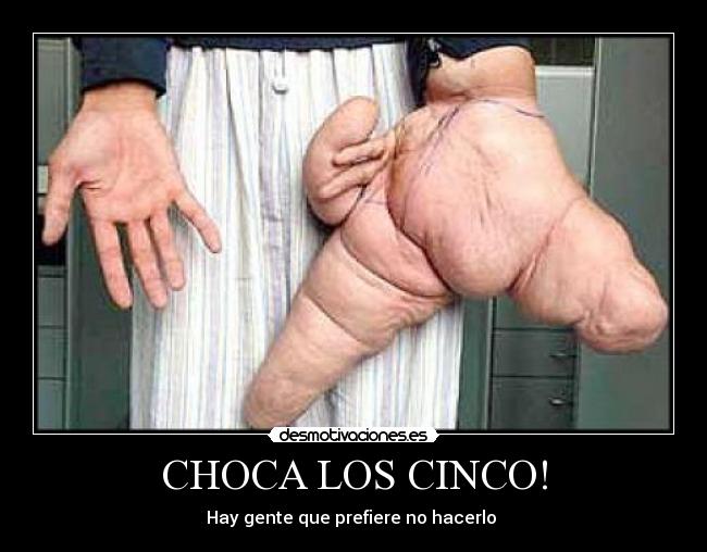 CHOCA LOS CINCO! - 