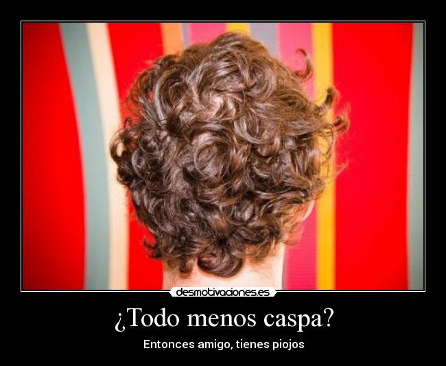 ¿Todo menos caspa? - Entonces amigo, tienes piojos