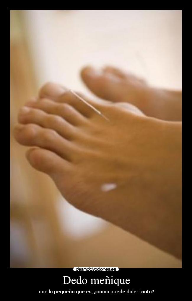 Dedo meñique - con lo pequeño que es, ¿como puede doler tanto?