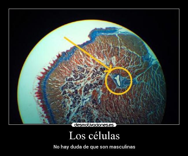 Los células - No hay duda de que son masculinas