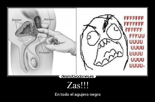 Zas!!! -