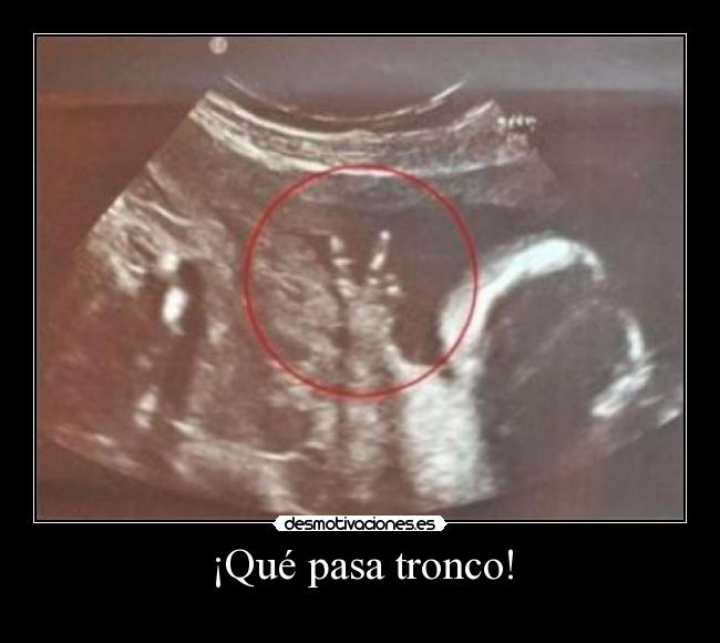 ¡Qué pasa tronco! -