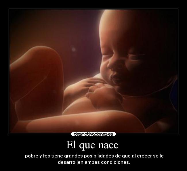 El que nace  -  pobre y feo tiene grandes posibilidades de que al crecer se le
desarrollen ambas condiciones.