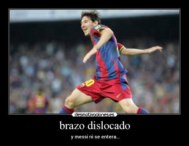 brazo dislocado - y messi ni se entera...