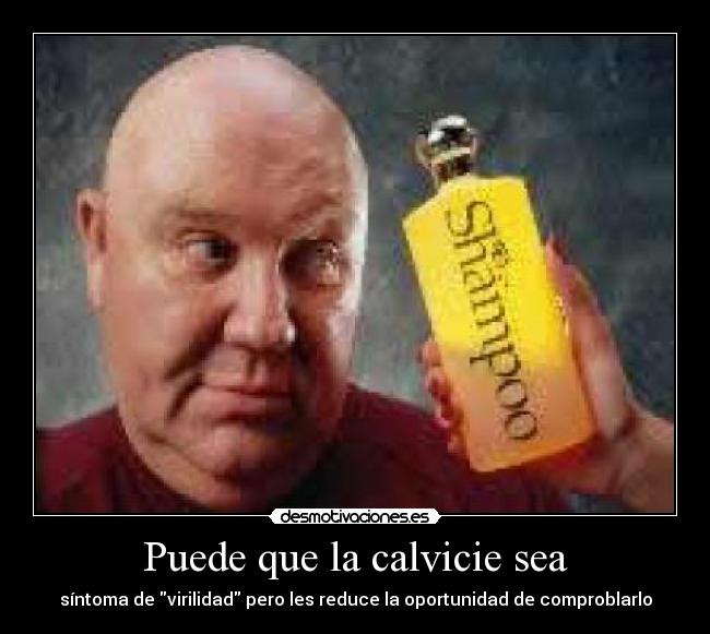carteles puede que calvicie sea sintoma virilidad pero les reduce capacidad comproblarlo desmotivaciones