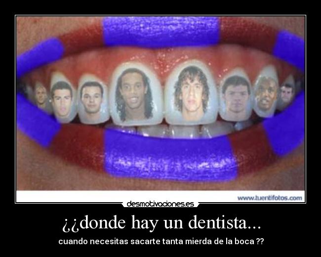 ¿¿donde hay un dentista... - cuando necesitas sacarte tanta mierda de la boca ??