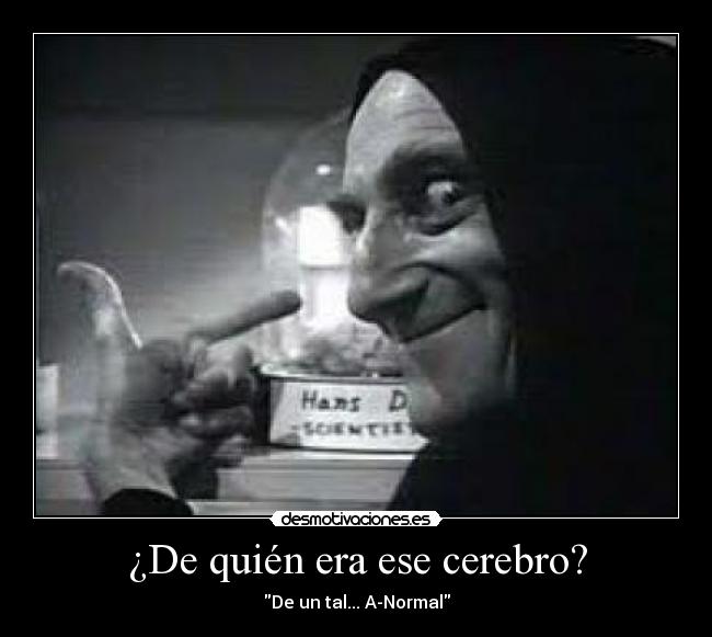 ¿De quién era ese cerebro? - De un tal... A-Normal