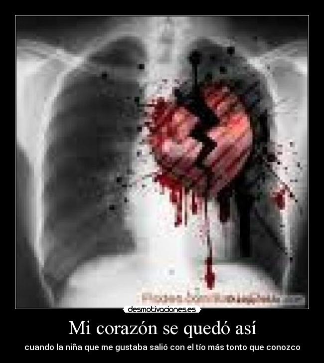 Mi corazón se quedó así - 
