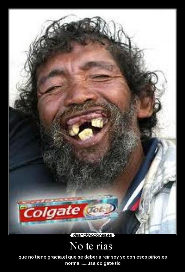No te rias - que no tiene gracia,el que se deberia reir soy yo,con esos piños es
normal......usa colgate tio