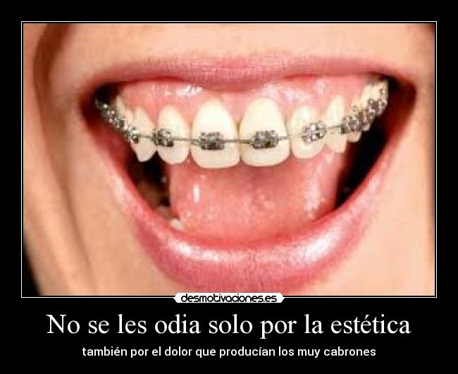 No se les odia solo por la estética - 