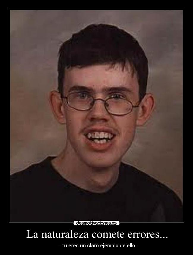 La naturaleza comete errores... -