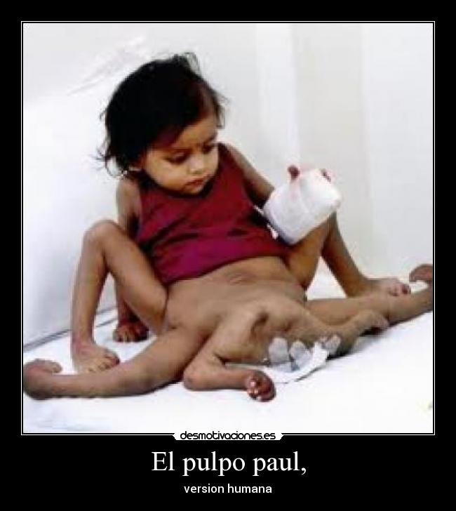 El pulpo paul, - version humana
