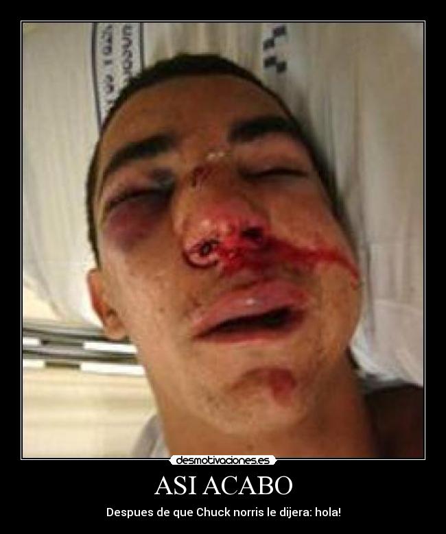 ASI ACABO - Despues de que Chuck norris le dijera: hola!
