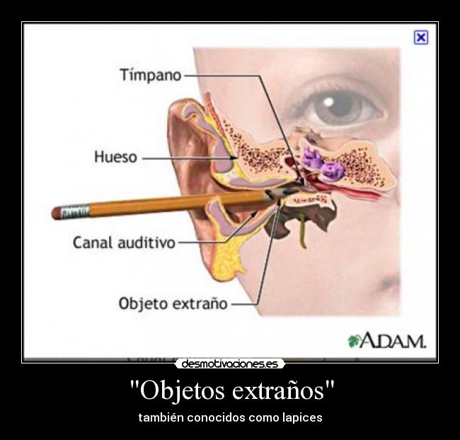 Objetos extraños - también conocidos como lapices