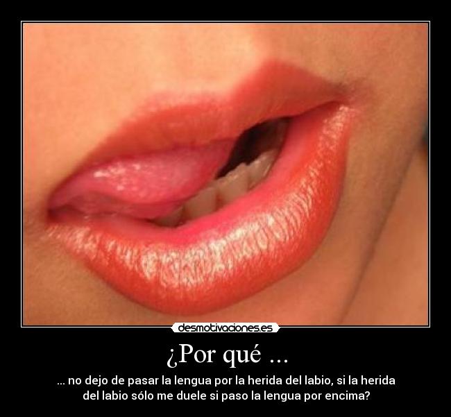 ¿Por qué ... - ... no dejo de pasar la lengua por la herida del labio, si la herida
del labio sólo me duele si paso la lengua por encima?