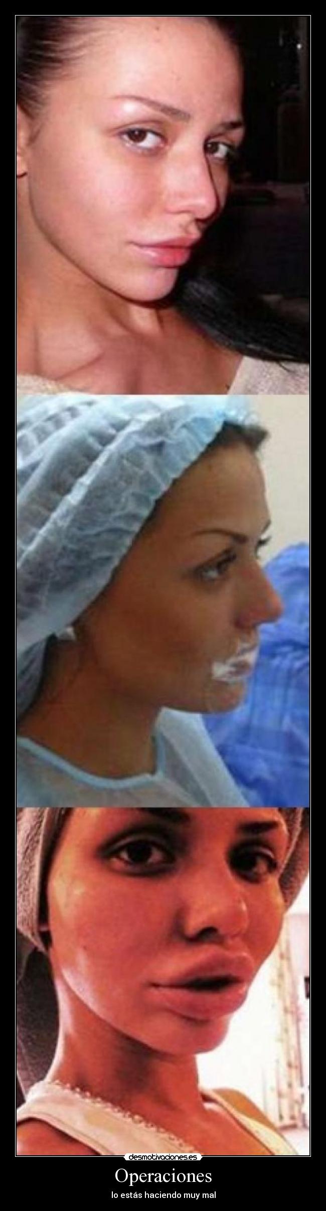 Operaciones - lo estás haciendo muy mal