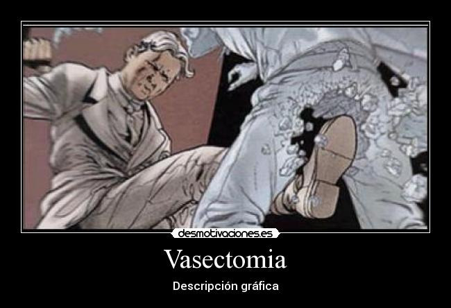 Vasectomia - Descripción gráfica