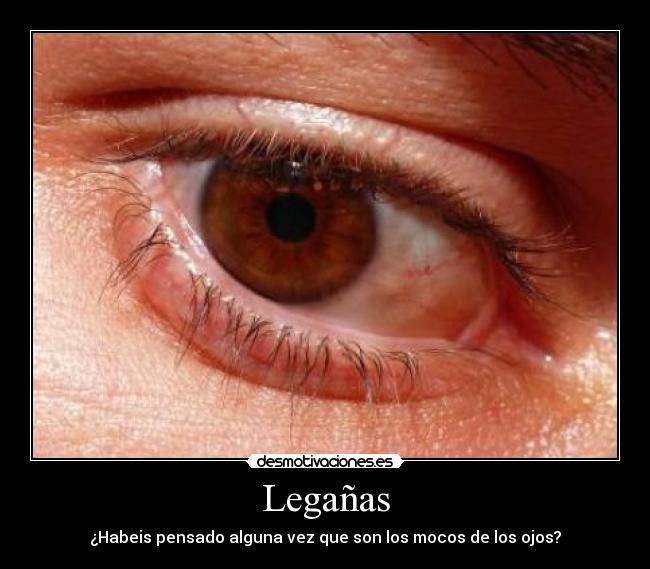 Legañas - ¿Habeis pensado alguna vez que son los mocos de los ojos?