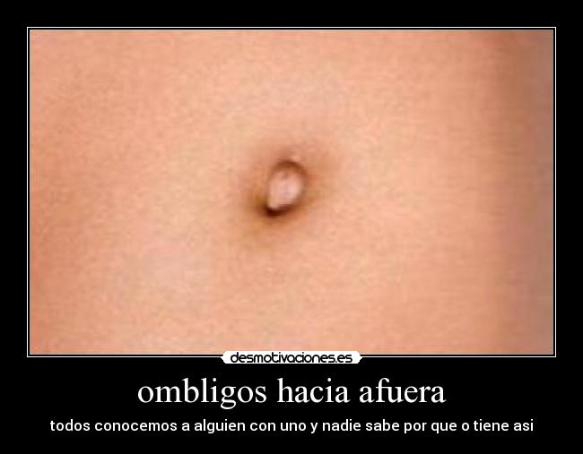 ombligos hacia afuera -