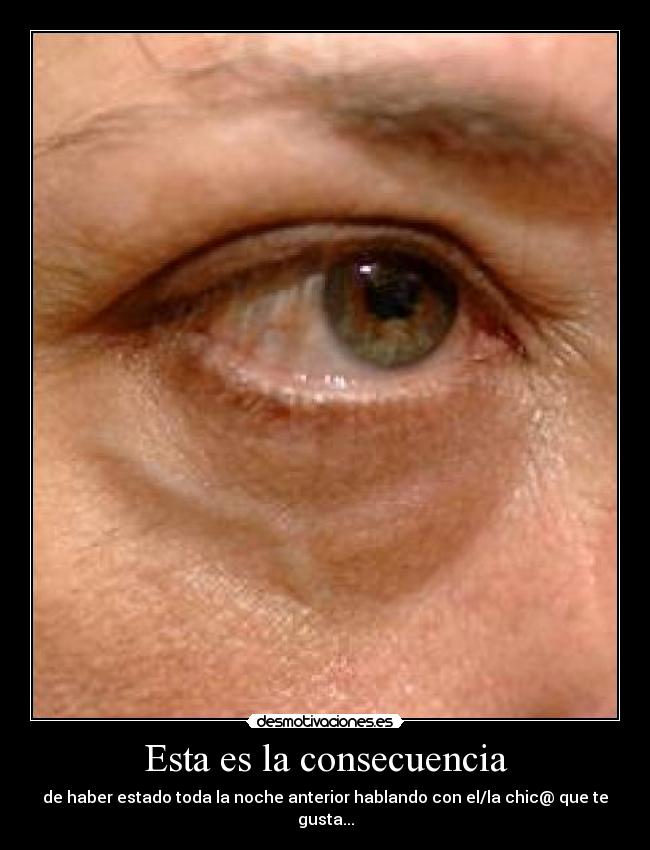 Esta es la consecuencia -