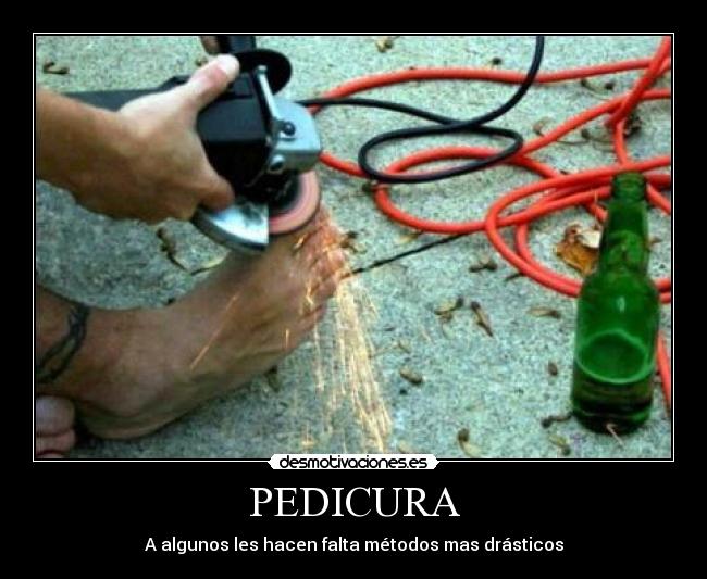 PEDICURA - A algunos les hacen falta métodos mas drásticos