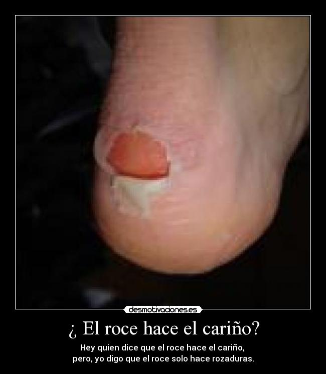 ¿ El roce hace el cariño? - Hey quien dice que el roce hace el cariño,
pero, yo digo que el roce solo hace rozaduras.