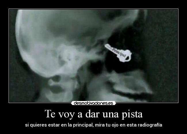 Te voy a dar una pista - si quieres estar en la principal, mira tu ojo en esta radiografía