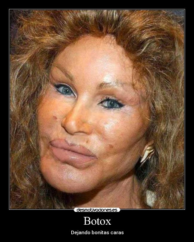 Botox -