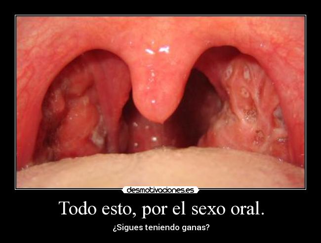 Todo esto, por el sexo oral. - 