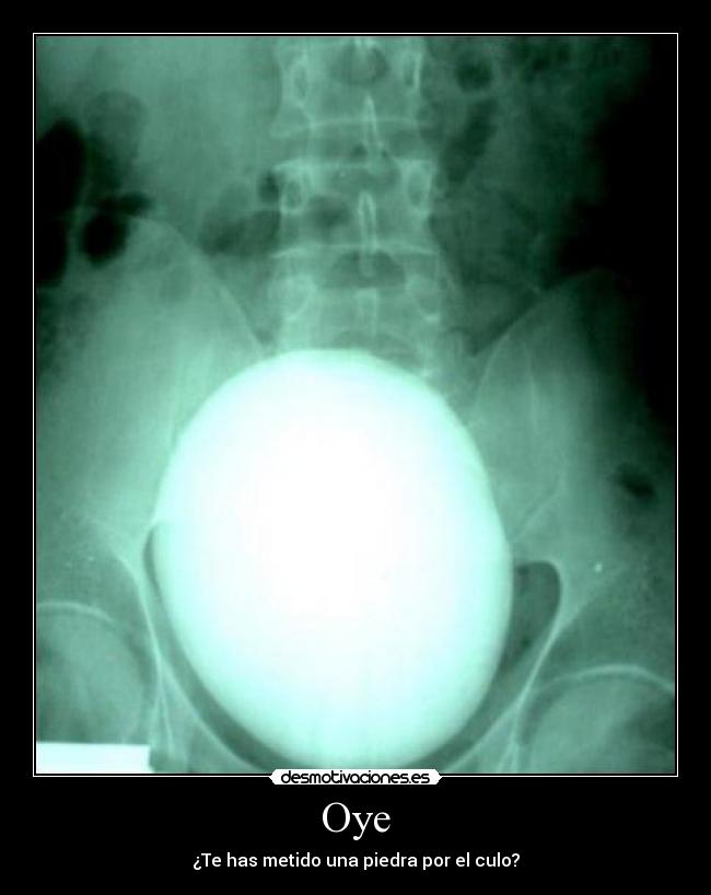 Oye - ¿Te has metido una piedra por el culo?