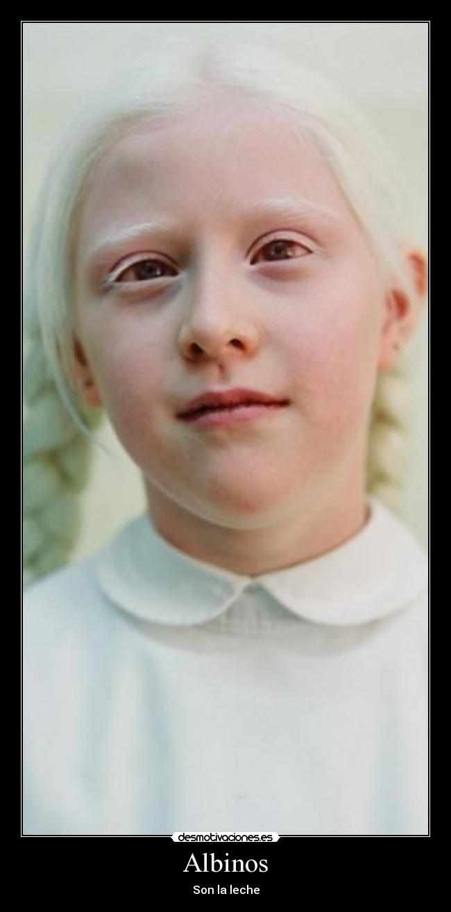 Albinos - 