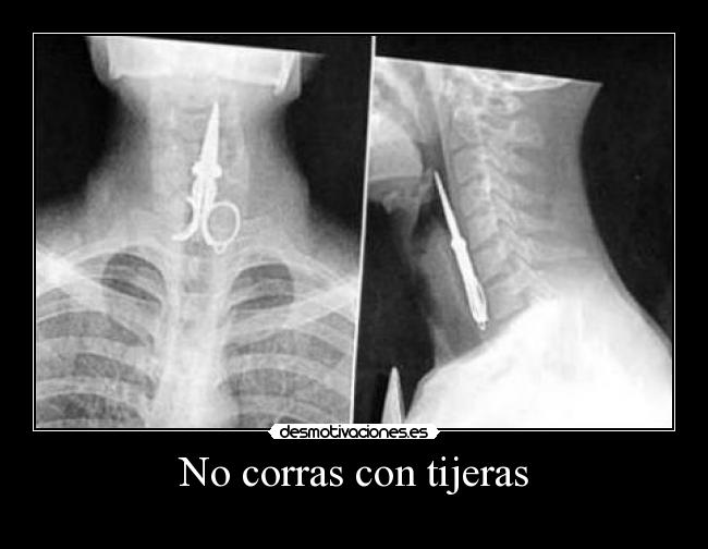 No corras con tijeras - 