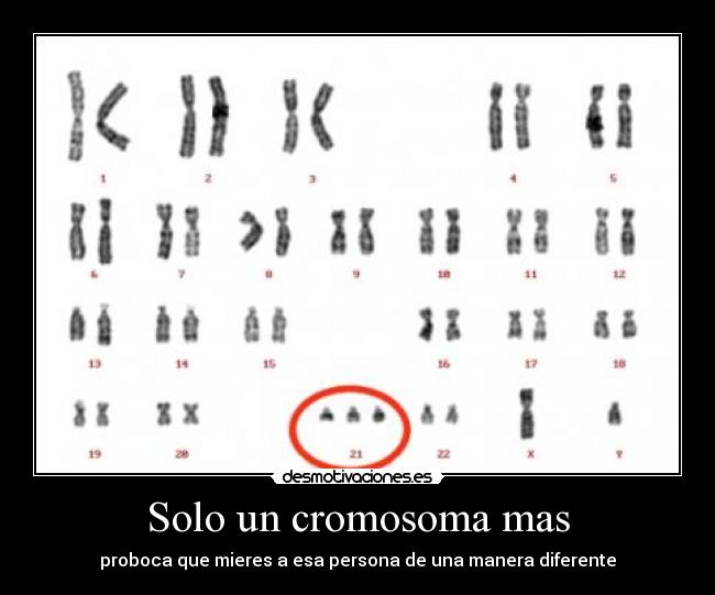 Solo un cromosoma mas - proboca que mieres a esa persona de una manera diferente