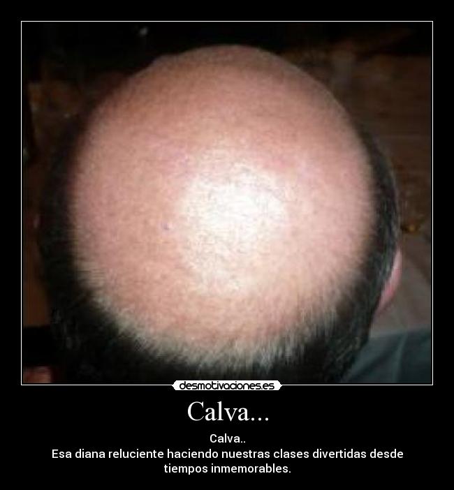 Calva... - 