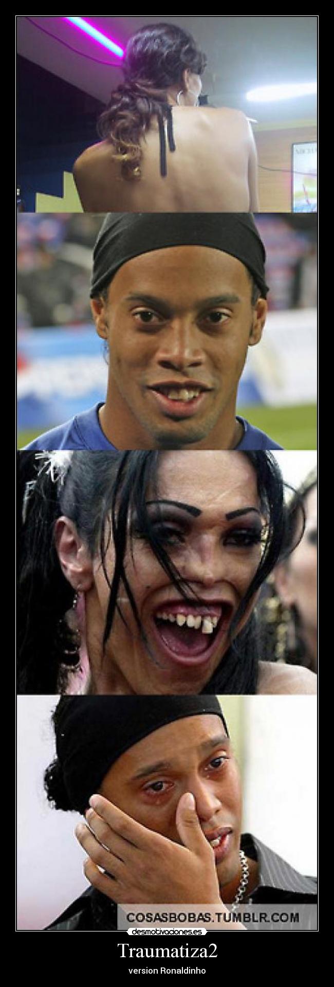 Traumatiza2 - version Ronaldinho
