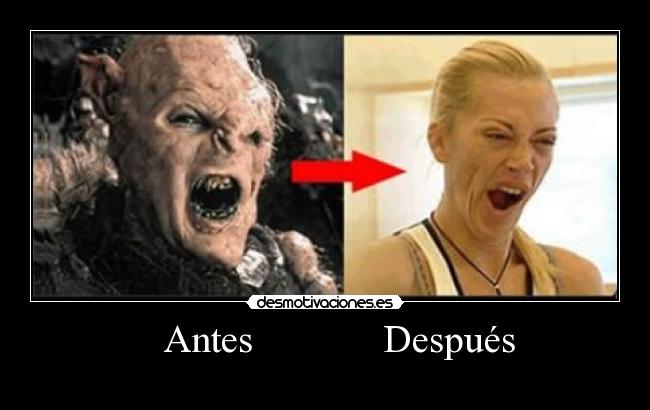    Antes             Después - 