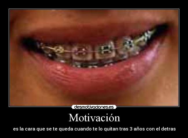 Motivación - es la cara que se te queda cuando te lo quitan tras 3 años con el detras