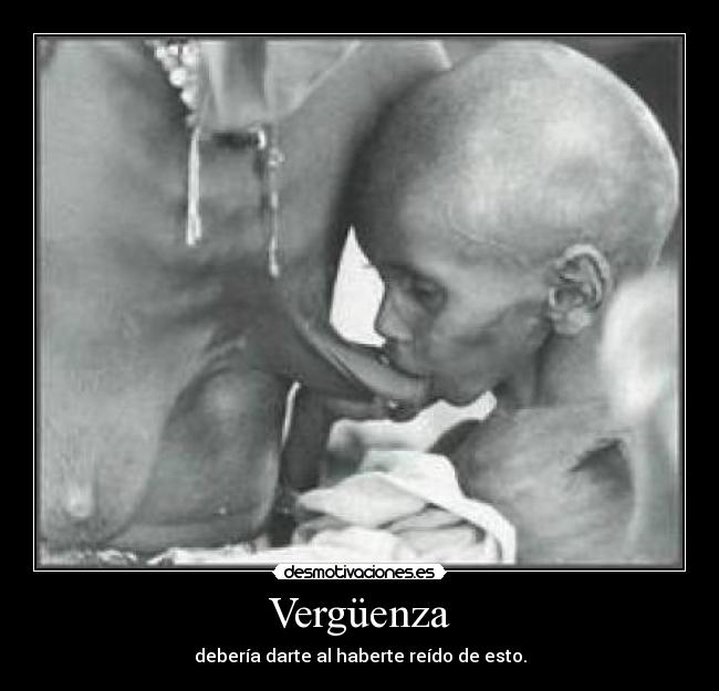 Vergüenza -