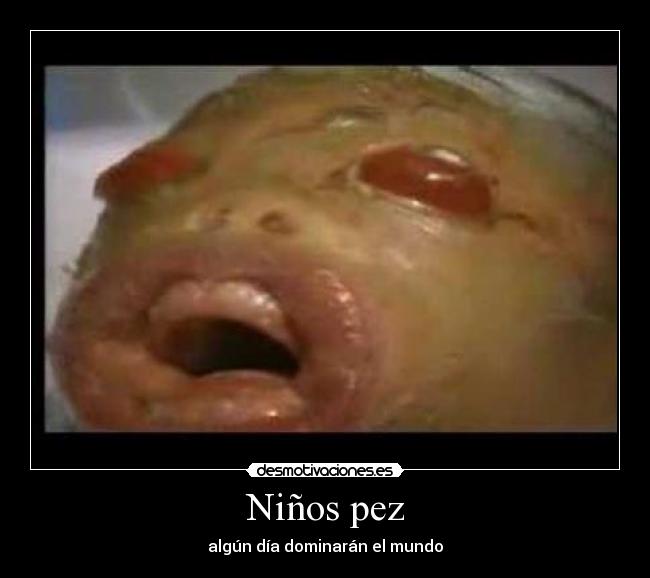 Niños pez -