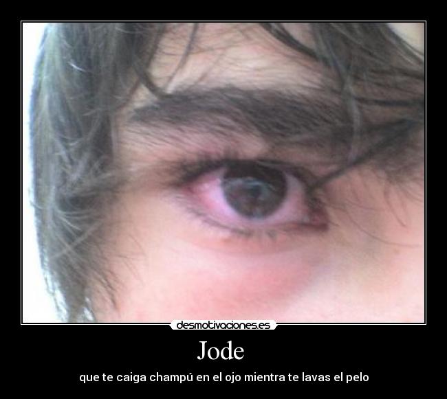 Jode - que te caiga champú en el ojo mientra te lavas el pelo
