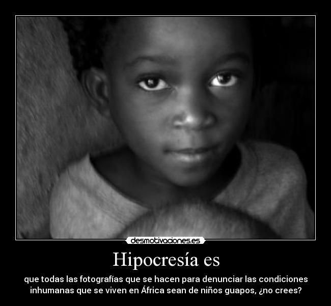 Hipocresía es - que todas las fotografías que se hacen para denunciar las condiciones
inhumanas que se viven en África sean de niños guapos, ¿no crees?