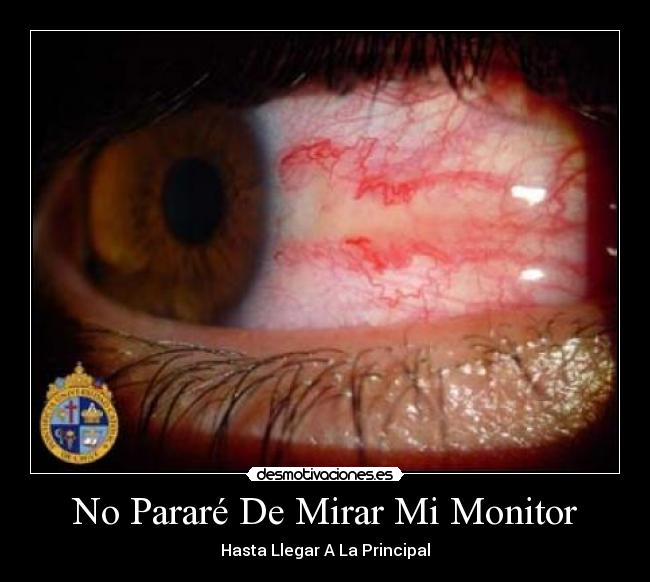 No Pararé De Mirar Mi Monitor - Hasta Llegar A La Principal