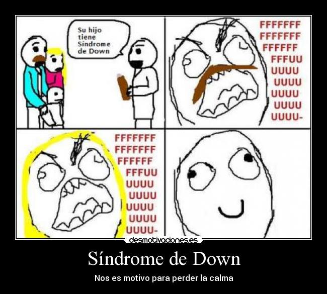 Síndrome de Down -