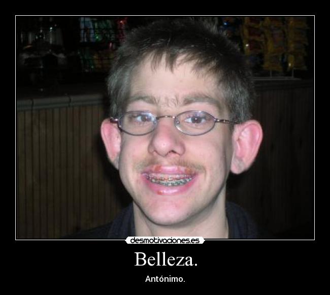 Belleza. - 