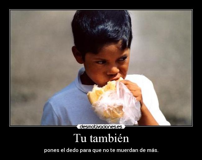 Tu también - pones el dedo para que no te muerdan de más.