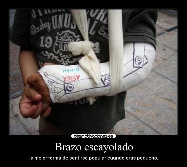 Brazo escayolado -