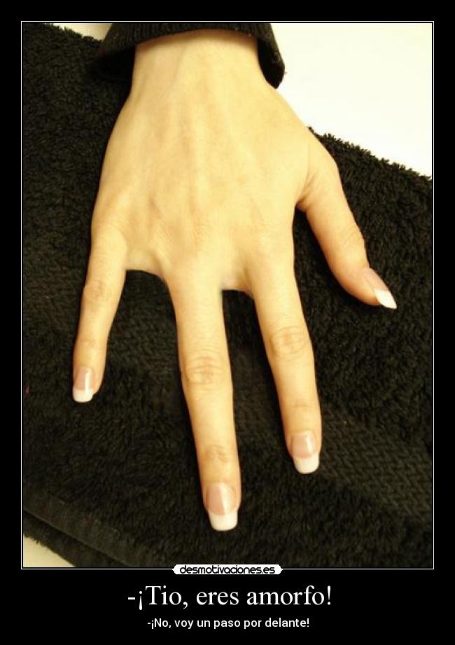 -¡Tio, eres amorfo! - 