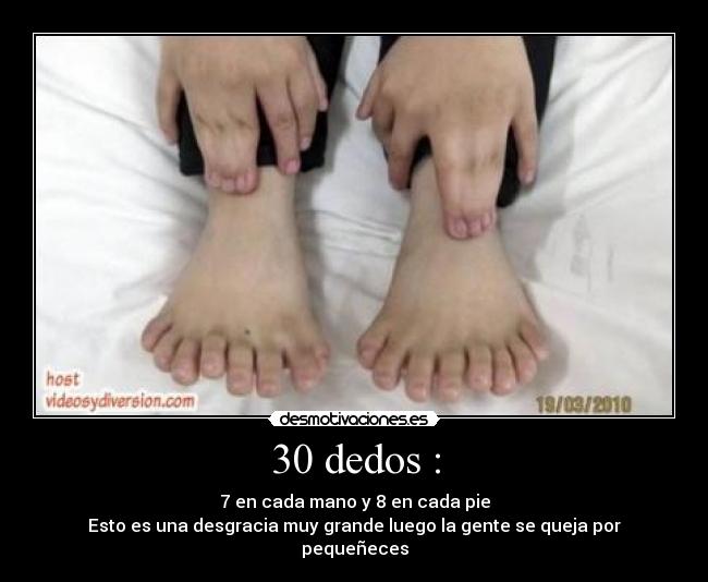 30 dedos : - 