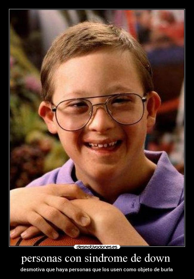 personas con sindrome de down  - desmotiva que haya personas que los usen como objeto de burla 