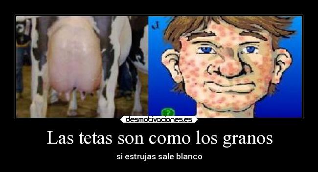 Las tetas son como los granos - 